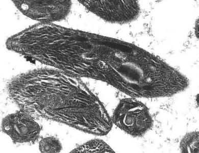 Bradozoítos de Besnoitia - microscopía electrónica